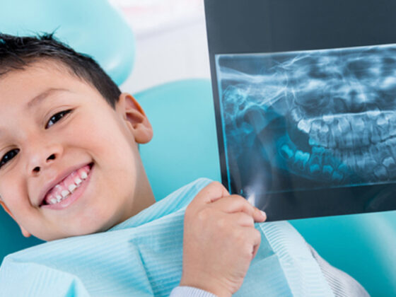 Dental X-Rays, Types, and Kids – Safe & Sound